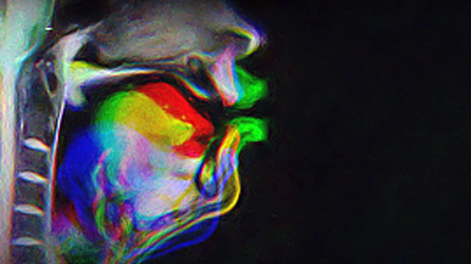 The Sensory Blueprint: Rethinking the Architecture of Human Speech