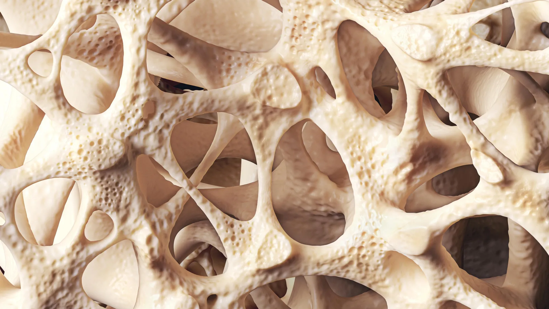 The Silent Epidemic: Understanding and Managing Osteopenia for Lifelong Bone Health