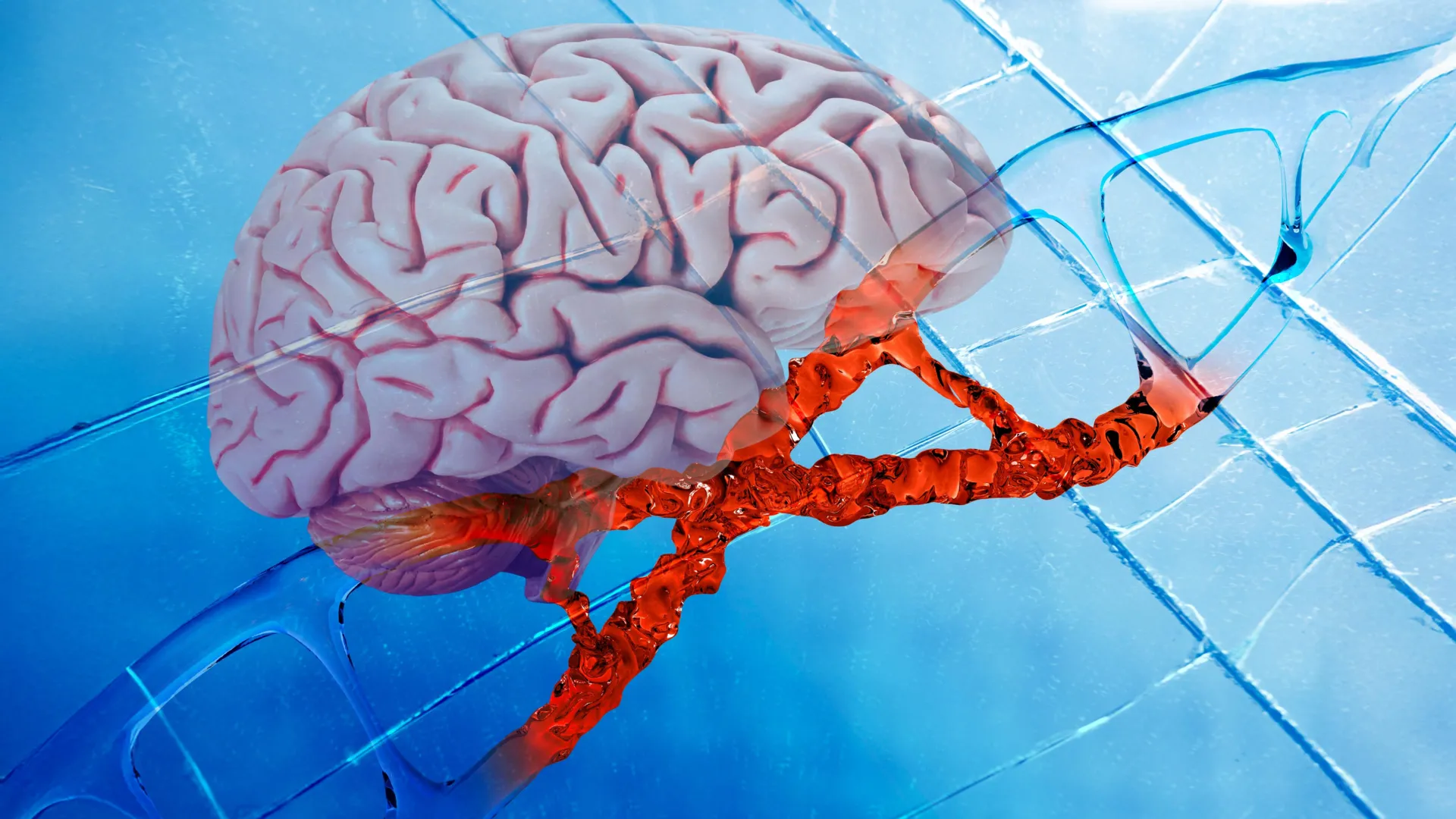 A New Frontier in Alzheimer’s Research: King’s College London Identifies Potential Disease-Modifying Drug
