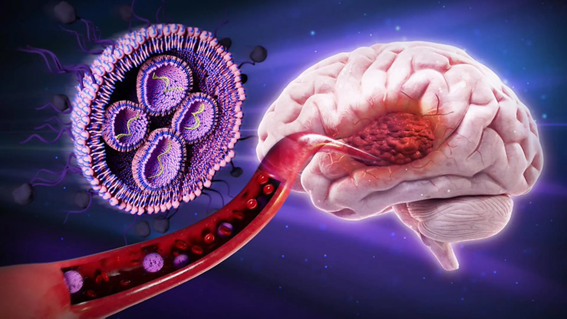 A Sweet Breakthrough: Oregon State Researchers Unlock New Pathway to Combat Glioblastoma