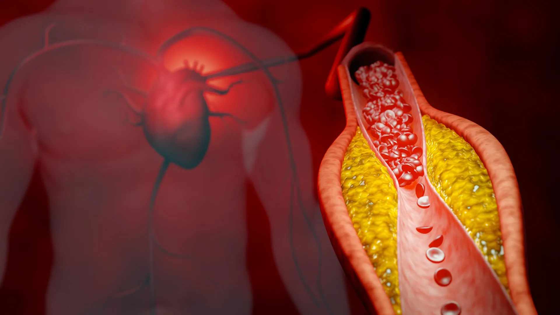 Beyond LDL: Is It Time to Rethink How We Measure Cardiovascular Risk?