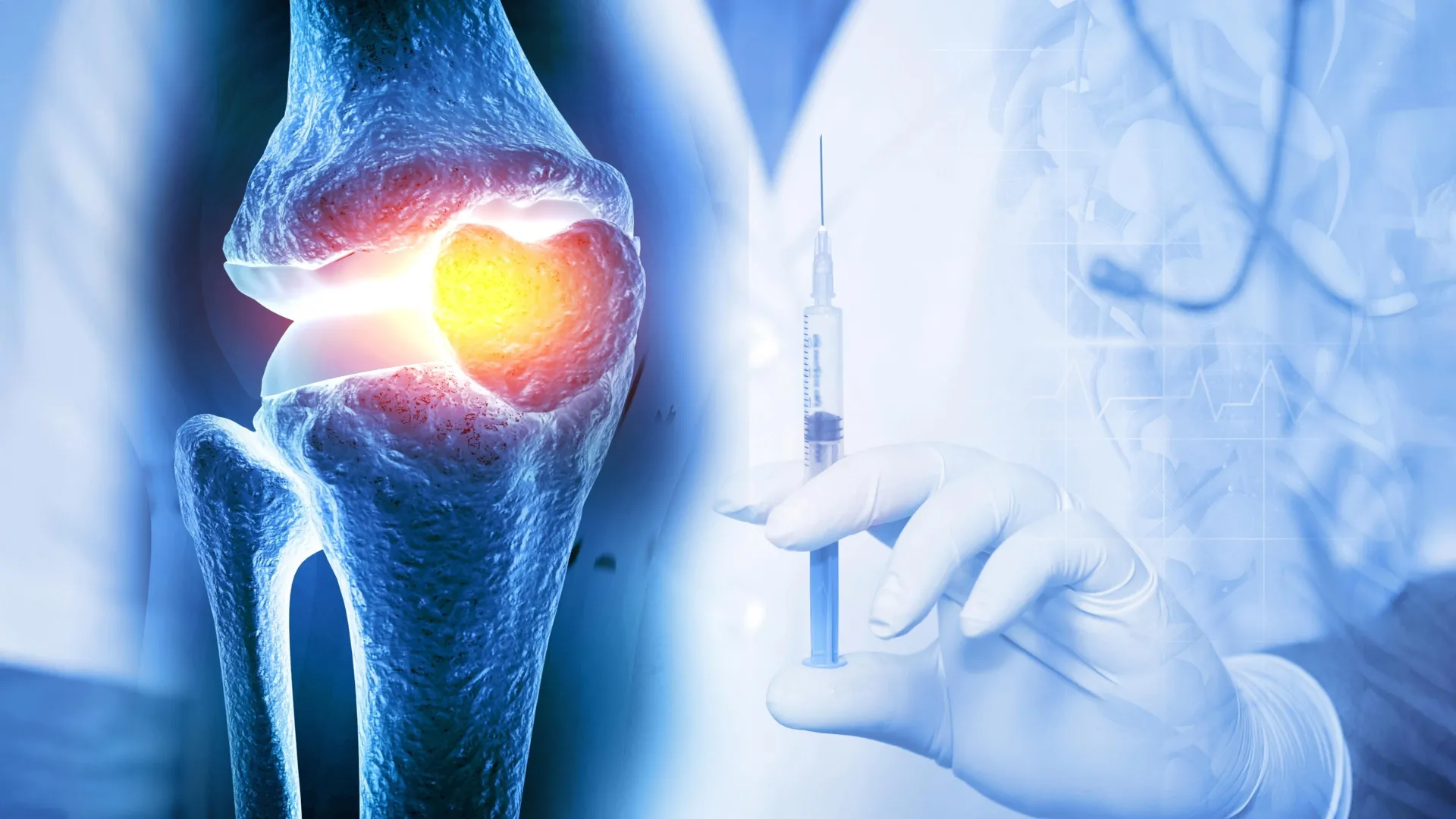 Beyond Pain Management: Colorado Researchers Pioneer Breakthrough Therapies to Reverse Osteoarthritis
