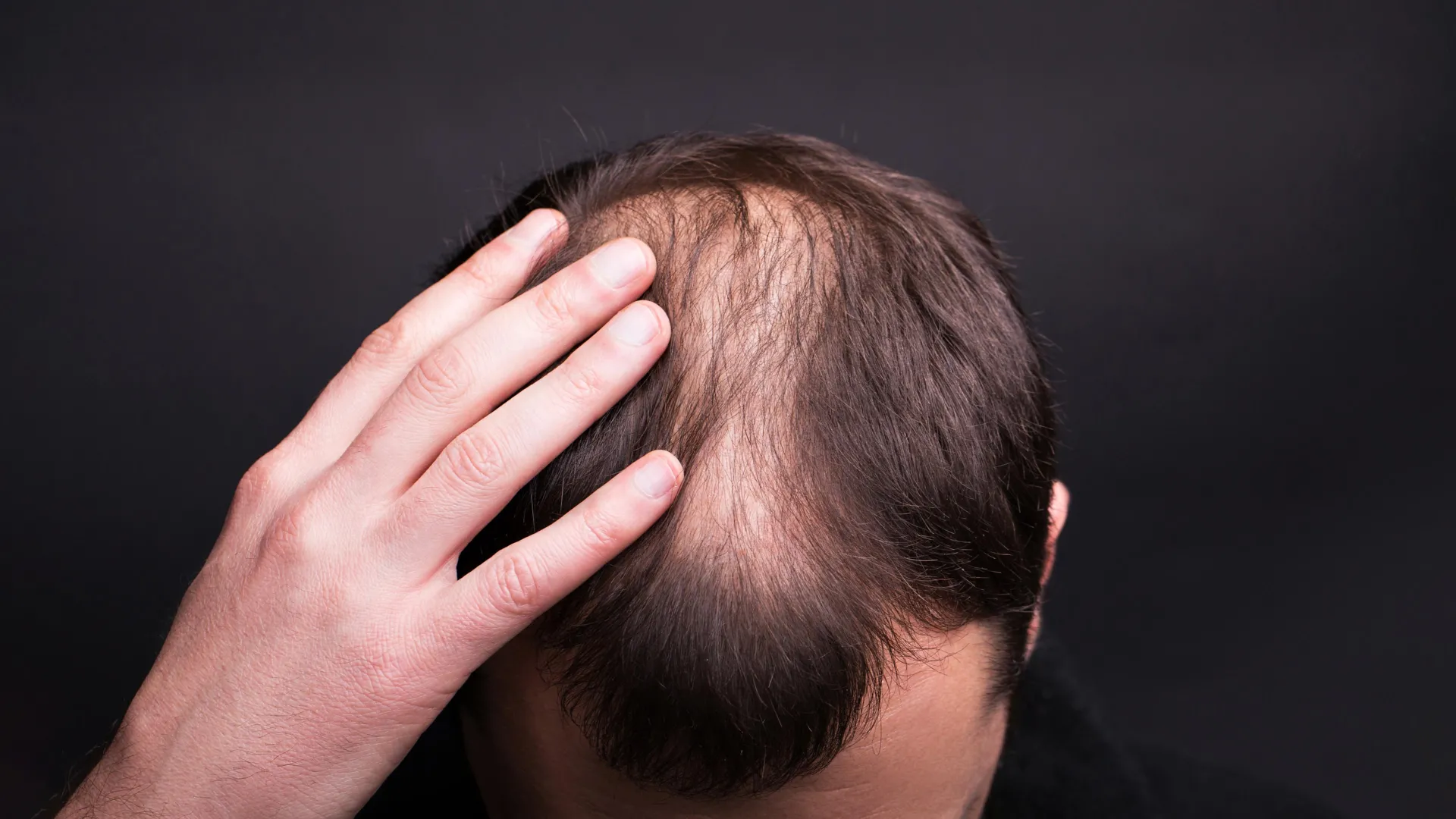Beyond the Conveyor Belt: Scientists Uncover the "Hidden Motor" Driving Human Hair Growth