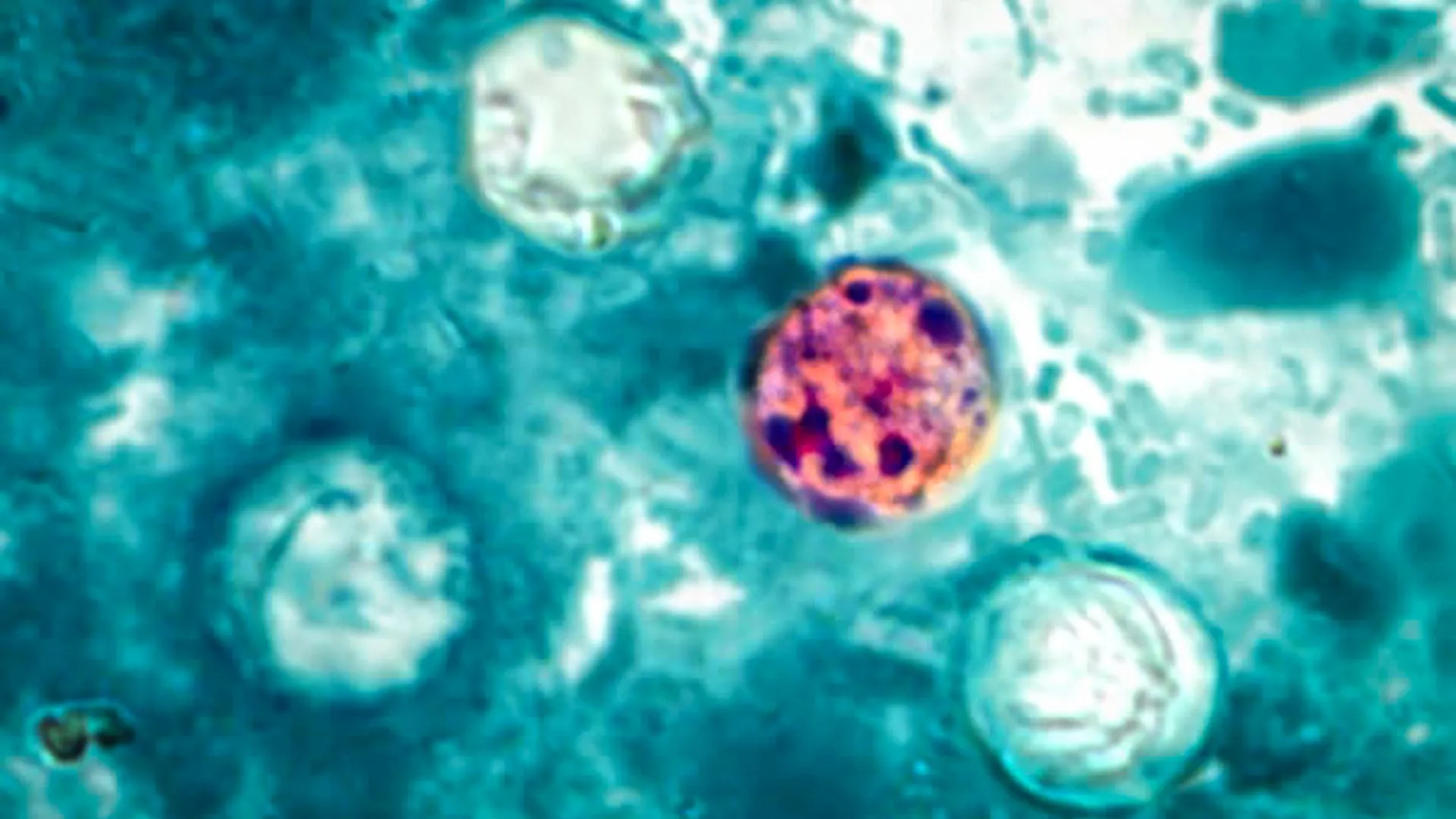 Multistate Cyclosporiasis Outbreak: Federal Health Agencies Scramble to Identify Contaminated Food Source
