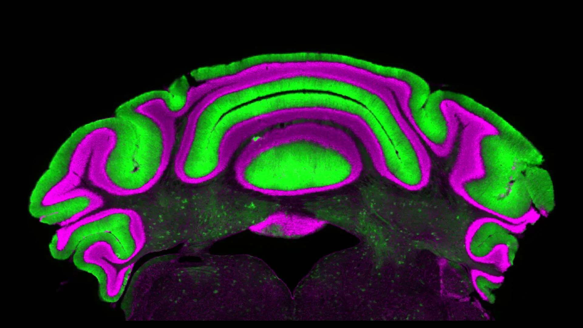 Rethinking the Cerebellum: Virginia Tech Study Challenges Decades of Neurological Assumptions