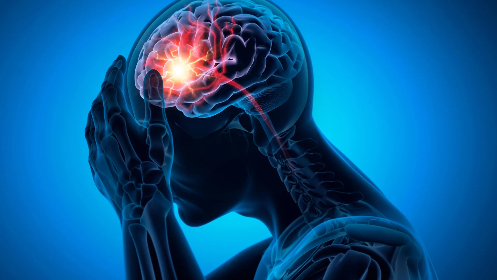 Rethinking the Stroke Paradigm: Why Artery Widening, Not Plaque, May Be the True Culprit in Lacunar Ischemic Stroke