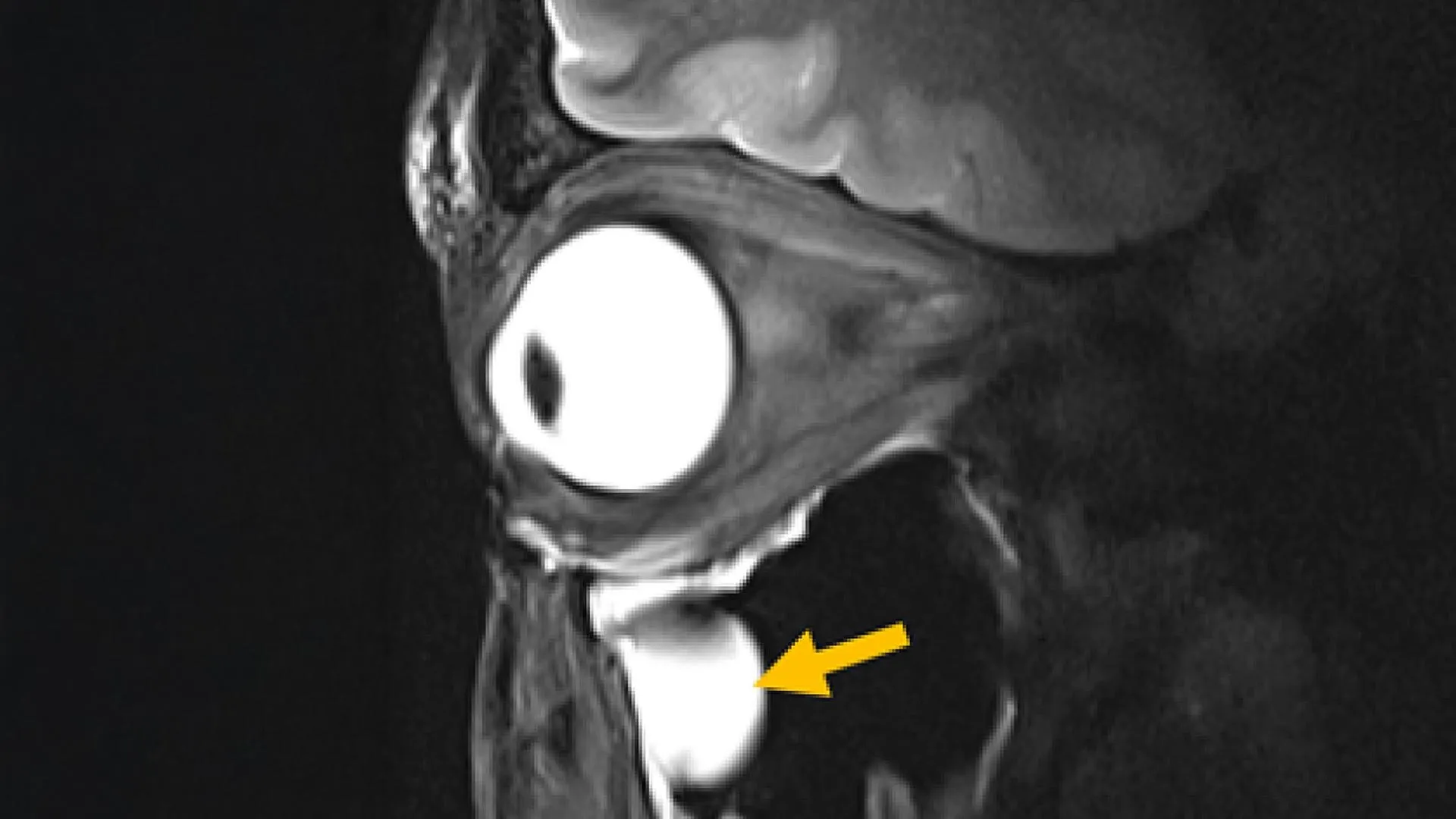 Sharpening the View: How Metamaterials are Revolutionizing MRI Technology