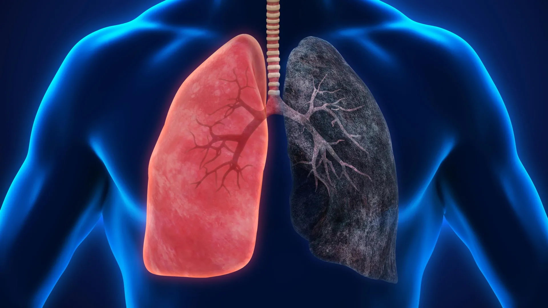 The Clouded Horizon: Investigating the Evolving Link Between Marijuana Use and Cancer Risk