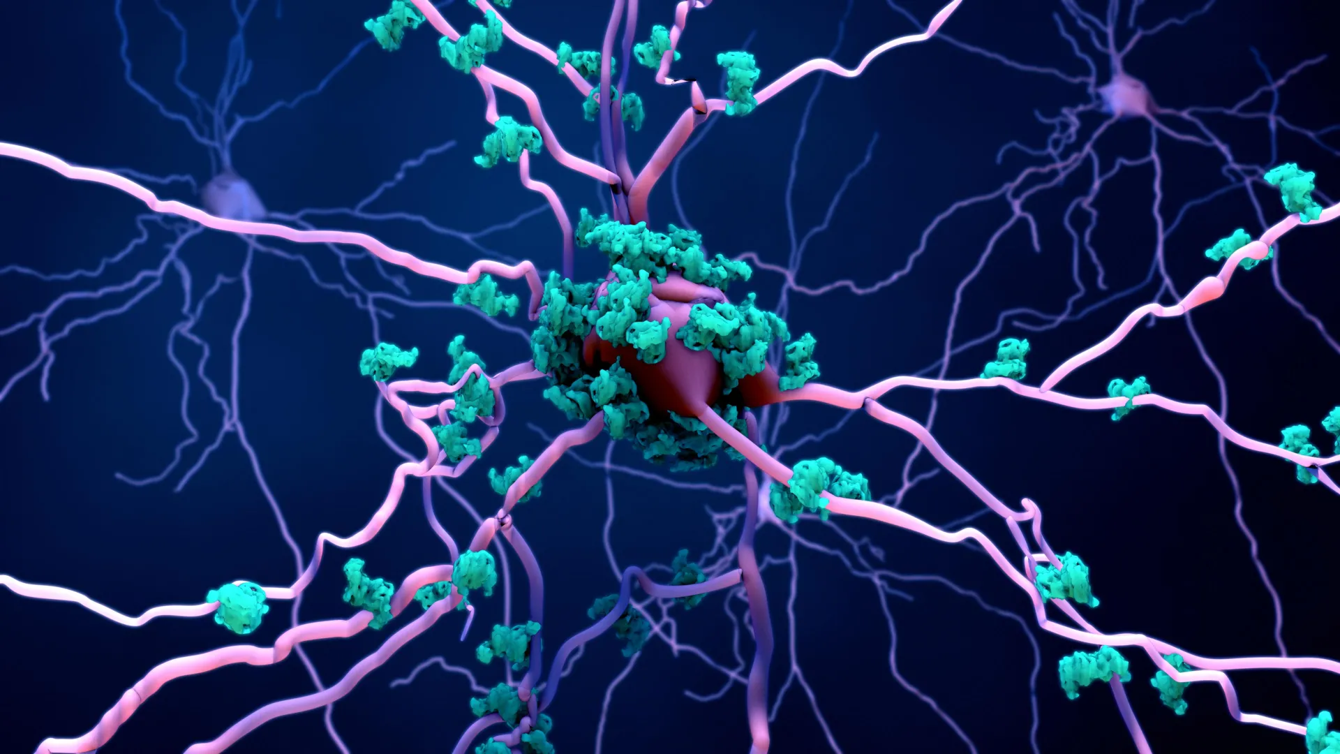The Missing Link: Scientists Uncover ‘Karyoptosis’ as a Driver of Brain Cell Death in Dementia