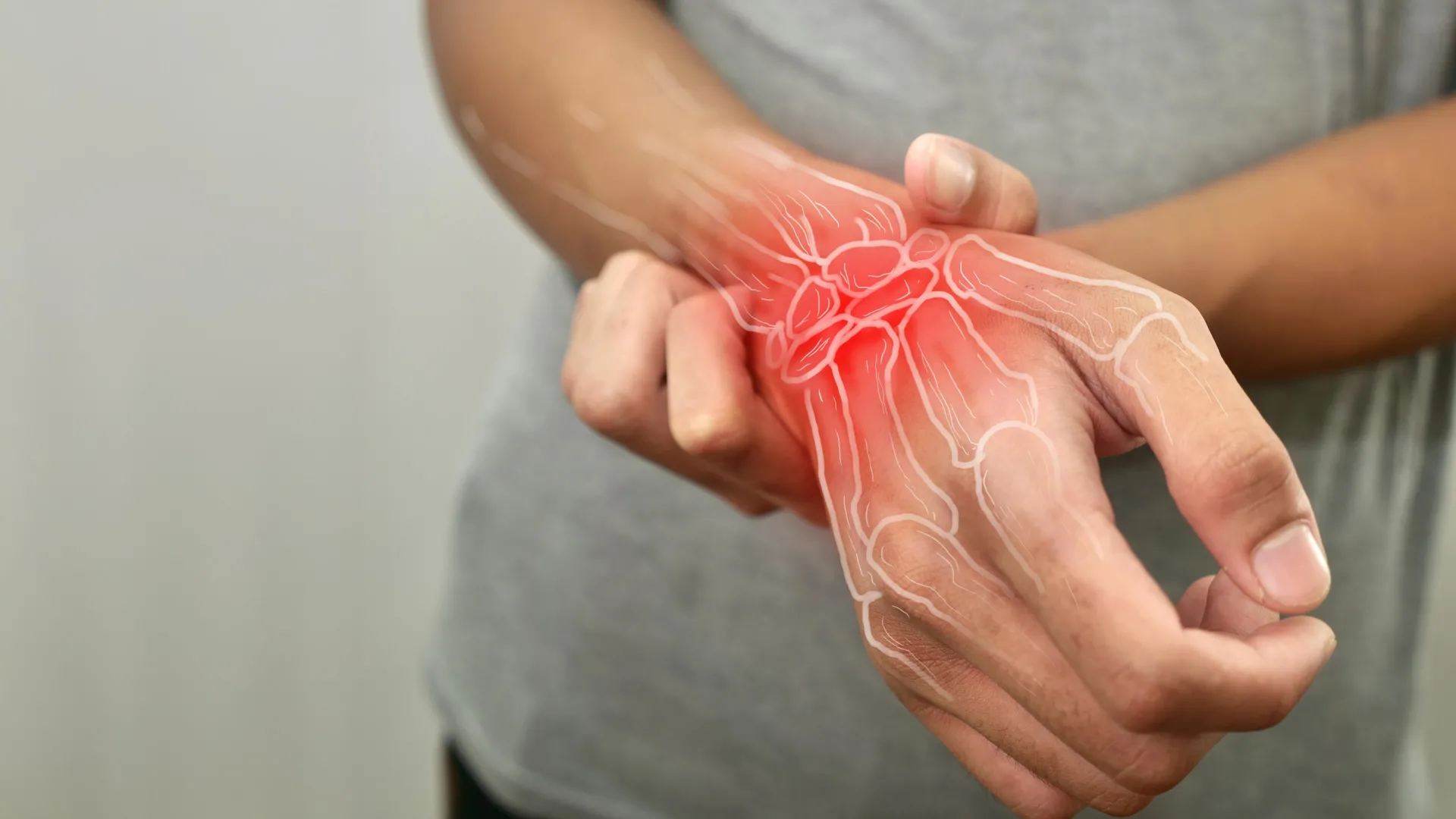 Unlocking New Frontiers in Rheumatoid Arthritis: The Therapeutic Promise of Obakulactone