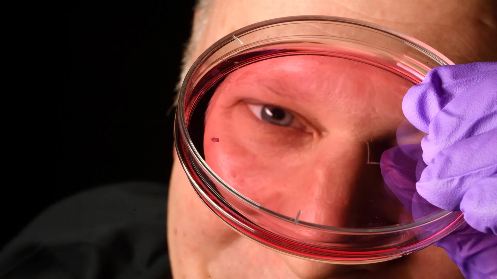 Unlocking the Blueprint of Sight: Johns Hopkins Scientists Reveal How the Human Eye Develops Sharp Vision