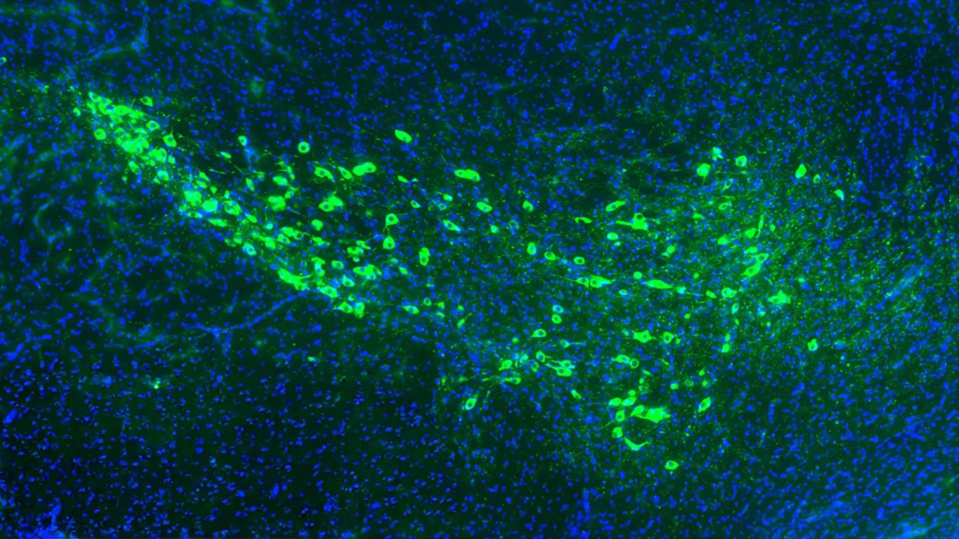Unlocking the Gatekeepers: Yale Researchers Identify Proteins That Drive Parkinson’s Disease Progression