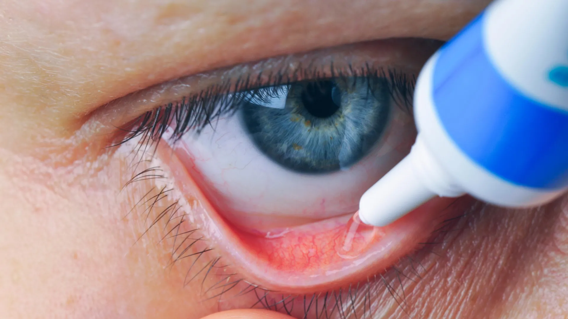 A New Dawn for the Blind: How “Molecular Prostheses” Are Revolutionizing Vision Restoration