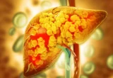 Beyond Weight Loss: New Clinical Trial Reveals Keto’s Superior Metabolic Edge