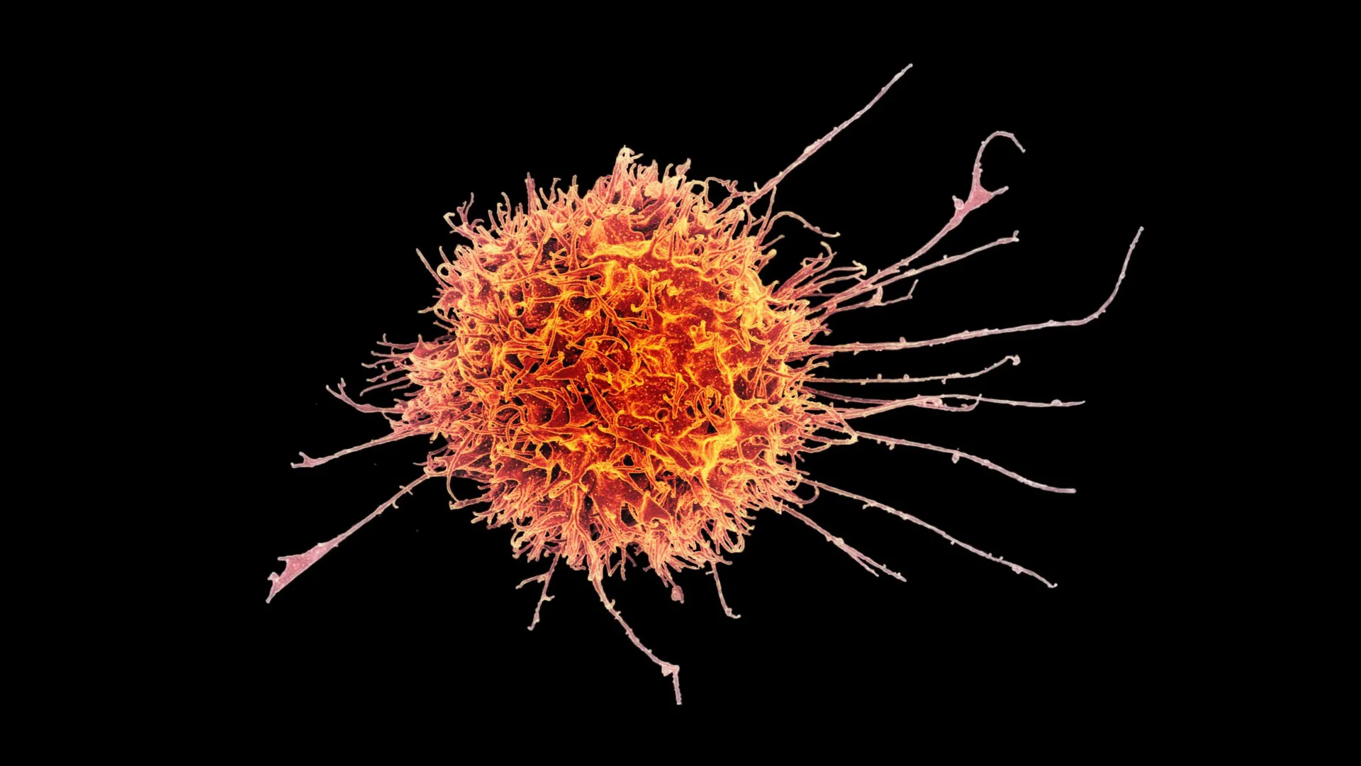 Breakthrough in Precision Oncology: Transforming Immune Cells to Conquer Solid Tumors