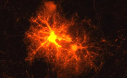Decoding the Brain’s Hidden Repair Mechanism: How Stress Hormones Orchestrate Myelin Recovery