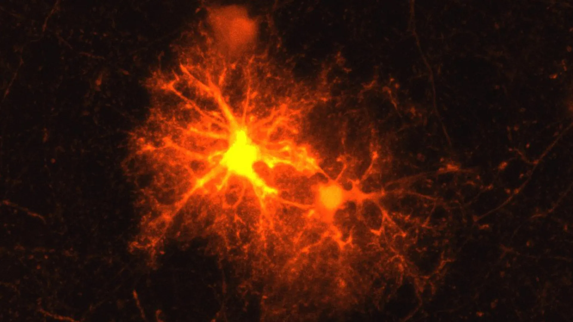 Decoding the Brain’s Hidden Repair Mechanism: How Stress Hormones Orchestrate Myelin Recovery