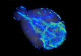 The Brain’s Midnight Cleanup Crew: How AI is Unlocking the Secrets of Glymphatic Flow