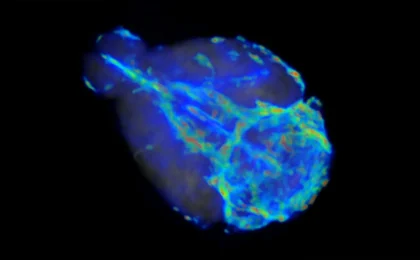 The Brain’s Midnight Cleanup Crew: How AI is Unlocking the Secrets of Glymphatic Flow