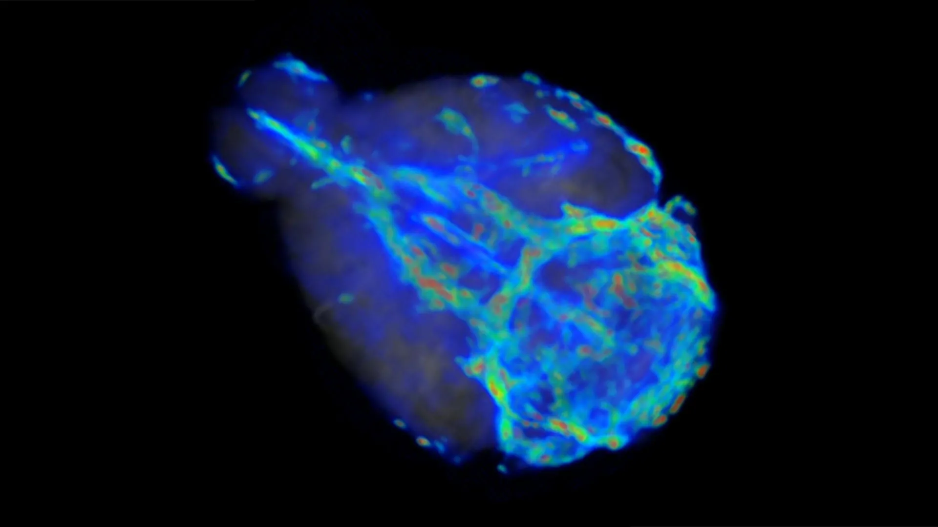 The Brain’s Midnight Cleanup Crew: How AI is Unlocking the Secrets of Glymphatic Flow