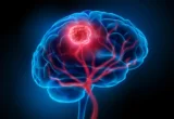 The "Double-Punch" Breakthrough: Engineering a Nano-Solution for Glioblastoma