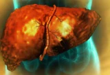 Trapped in Limbo: New Research Reveals Why Alcohol-Damaged Livers Cannot Heal