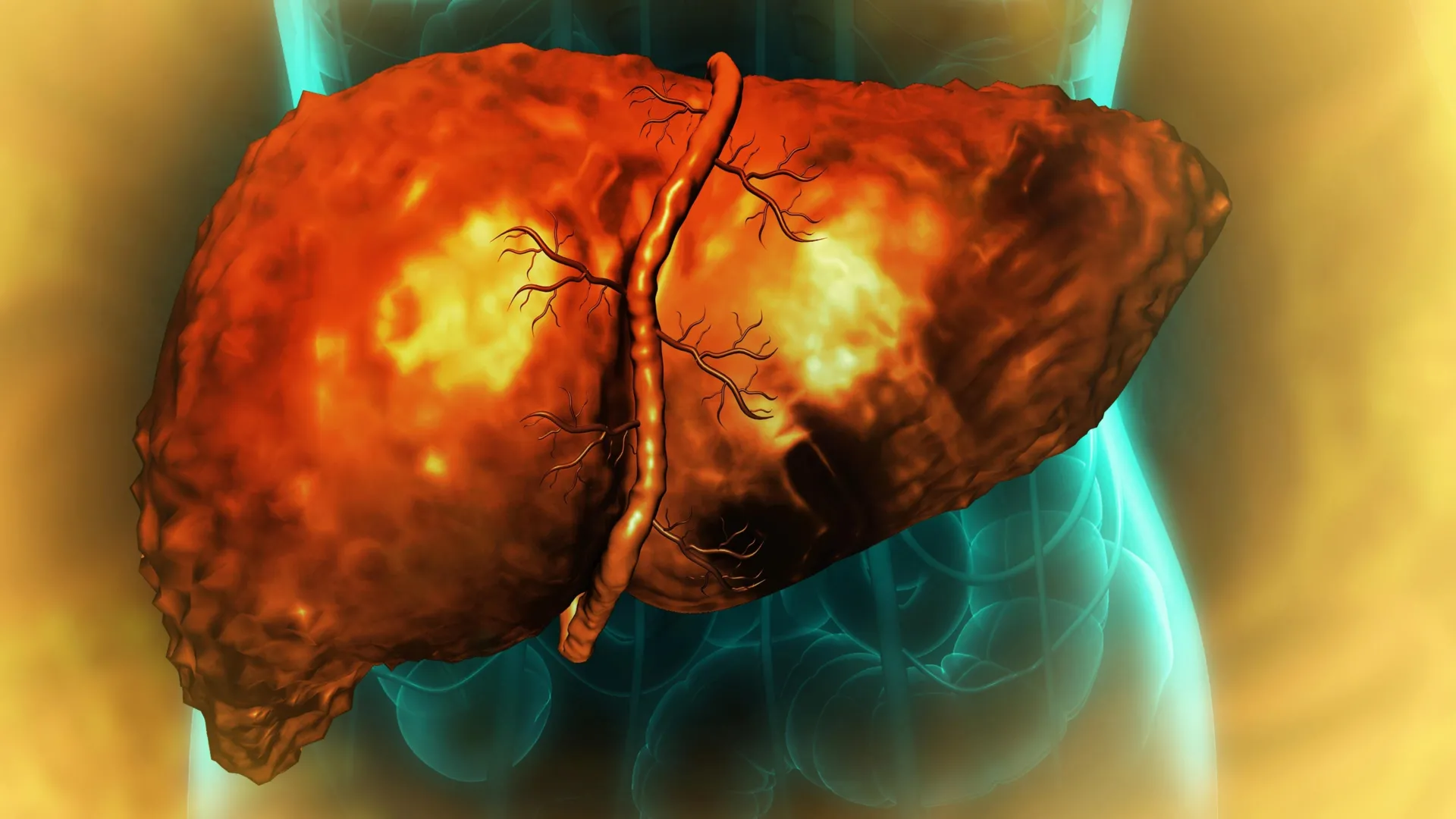 Trapped in Limbo: New Research Reveals Why Alcohol-Damaged Livers Cannot Heal