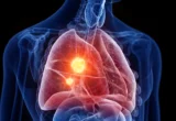 A New Frontier in Oncology: Challenging Mesothelioma with Mitochondrial Sabotage
