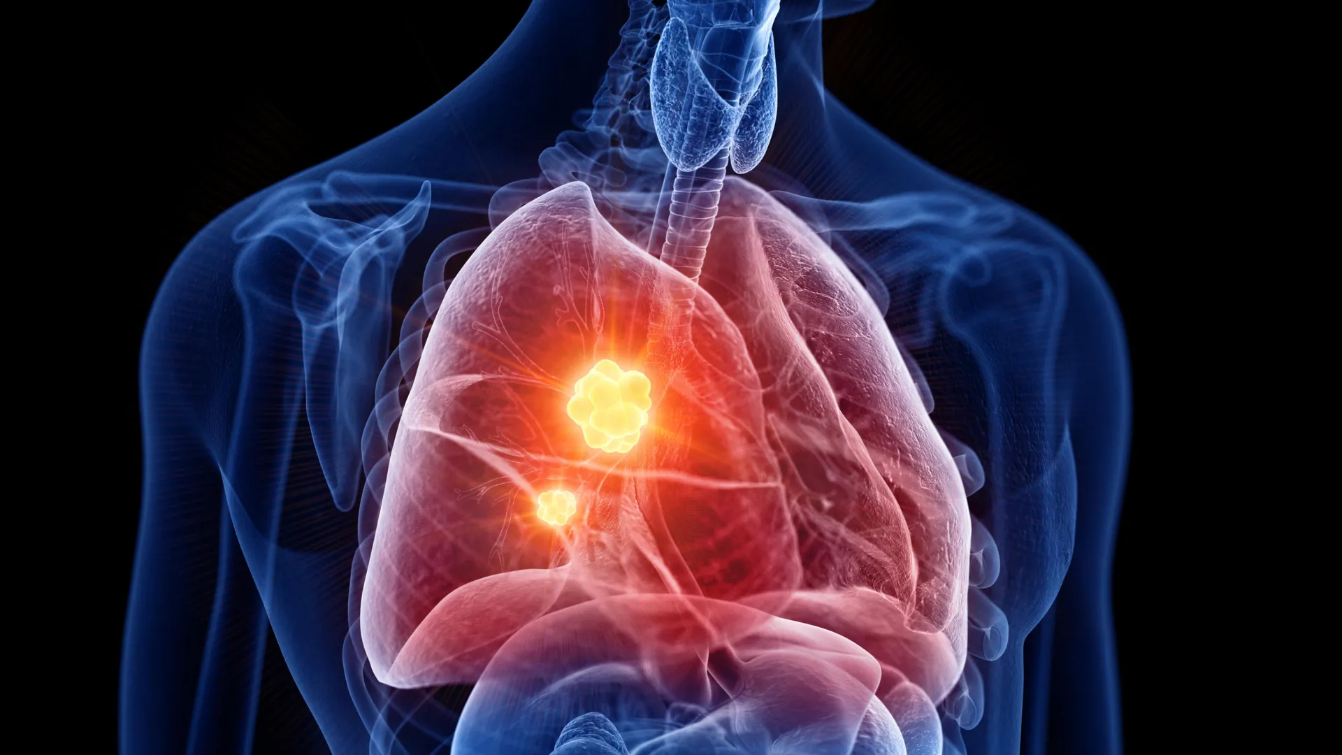 A New Frontier in Oncology: Challenging Mesothelioma with Mitochondrial Sabotage