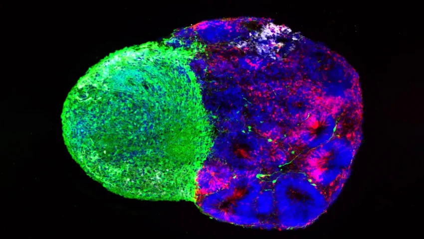 Decoding the Architect: New Insights into How Radial Glia Build the Human Brain