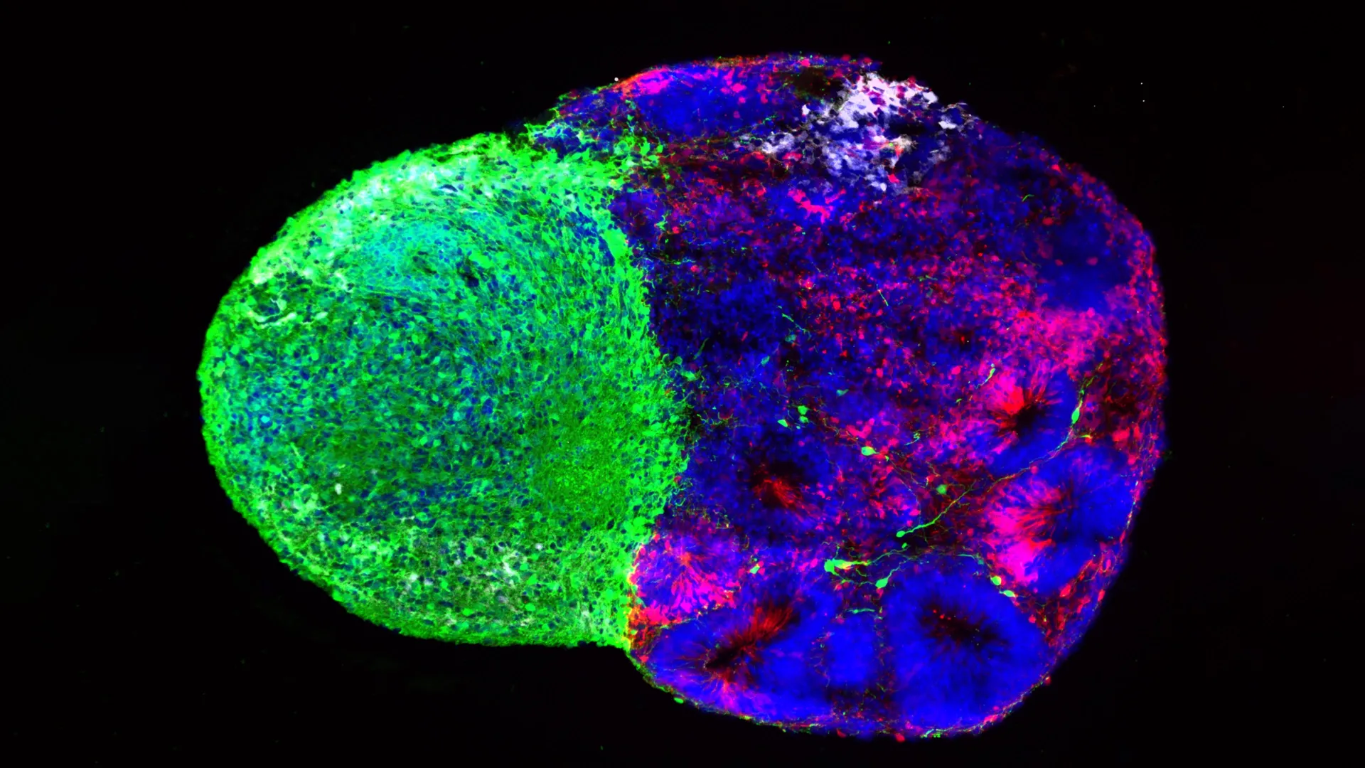 Decoding the Architect: New Insights into How Radial Glia Build the Human Brain