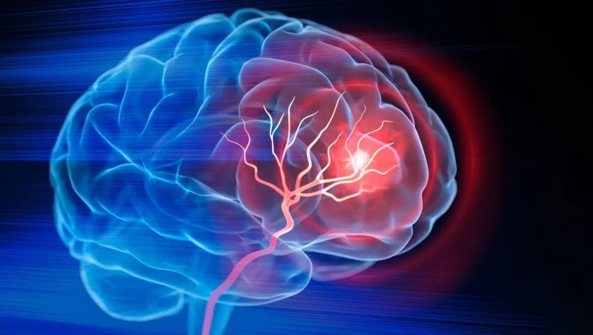 Engineering Recovery: How Duke Researchers Are Rebuilding the Post-Stroke Brain