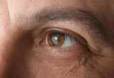 Long-Term Tadalafil Use Linked to Increased Glaucoma Risk: A Comprehensive Analysis