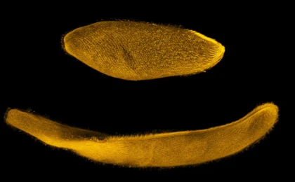 Nature’s Sprinter: Unlocking the Kinetic Secrets of Spirostomum ambiguum