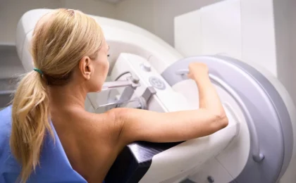 Rethinking the Scale of Breast Cancer Overdiagnosis: A New Perspective on Mammography Screening