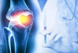 Revolutionizing Orthopedic Care: University at Buffalo’s Injectable Hydrogel Promises Long-Term Osteoarthritis Management