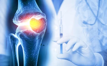 Revolutionizing Orthopedic Care: University at Buffalo’s Injectable Hydrogel Promises Long-Term Osteoarthritis Management