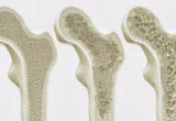 The Daily Brew: How Your Morning Coffee or Tea Habit Shapes Long-Term Bone Health