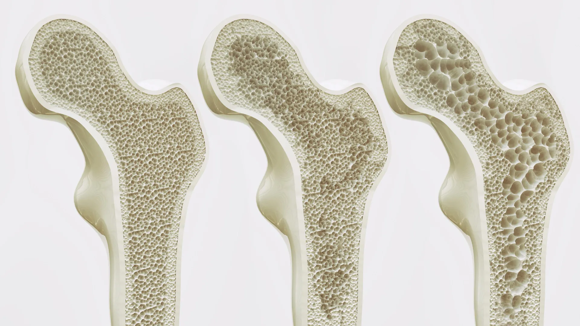The Daily Brew: How Your Morning Coffee or Tea Habit Shapes Long-Term Bone Health