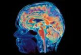 The Dual-Origin Brain: Stanford Researchers Uncover an Evolutionary Secret That Could Transform Neuroscience