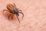 The Emergence of the Asian Longhorned Tick Nairovirus: A New Diagnostic Challenge in Asia