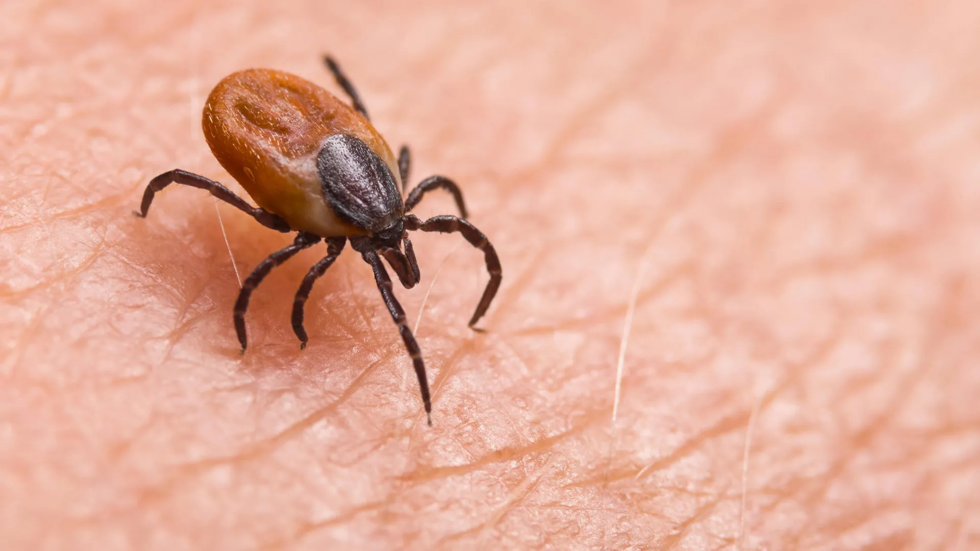 The Emergence of the Asian Longhorned Tick Nairovirus: A New Diagnostic Challenge in Asia