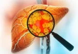 The Hidden Metabolic Cost: Why "Sugar-Free" Sorbitol May Not Be the Health Panacea We Assumed