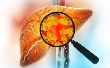 The Hidden Metabolic Cost: Why "Sugar-Free" Sorbitol May Not Be the Health Panacea We Assumed
