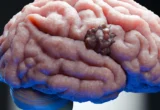 Unlocking a Biological Achilles’ Heel: New Research Targets Glioblastoma Resilience