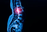 Unlocking the Blueprint of Motion: Breakthrough Discovery of Universal Tendon and Ligament Stem Cells