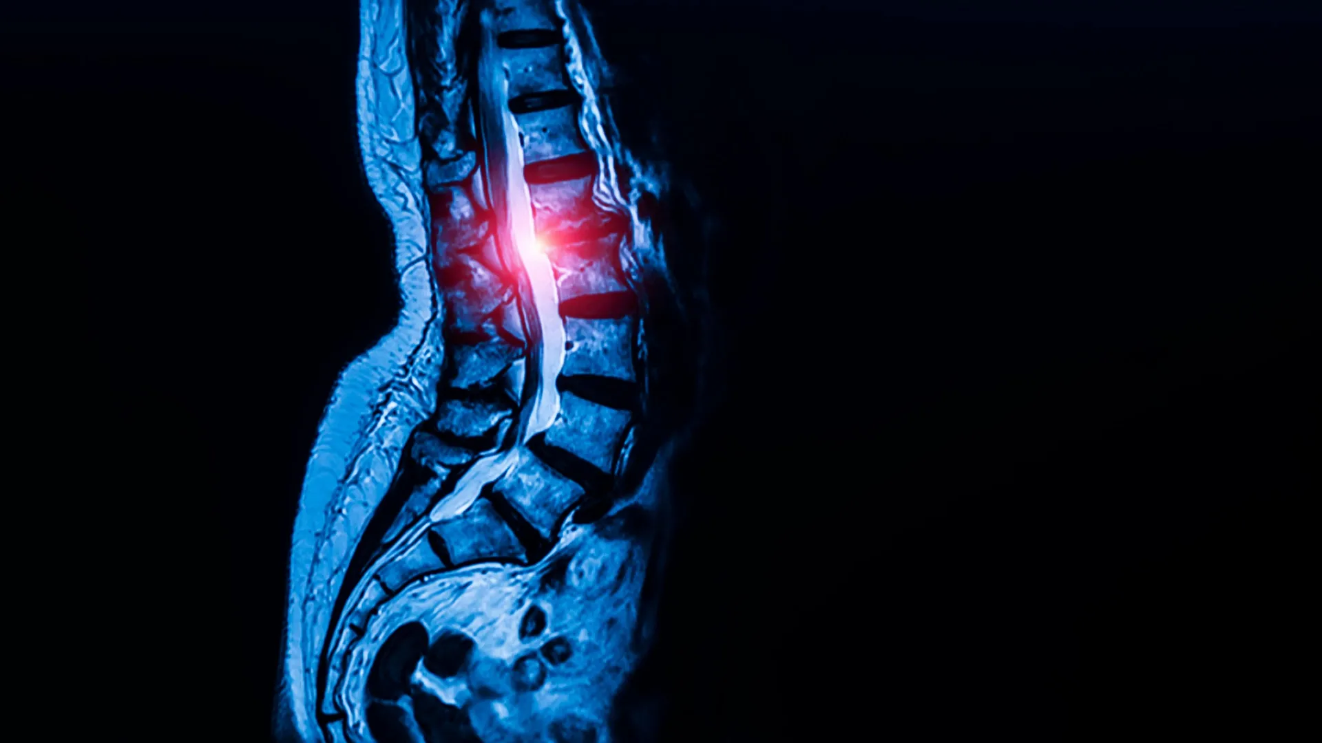 Unlocking the Blueprint of Motion: Breakthrough Discovery of Universal Tendon and Ligament Stem Cells