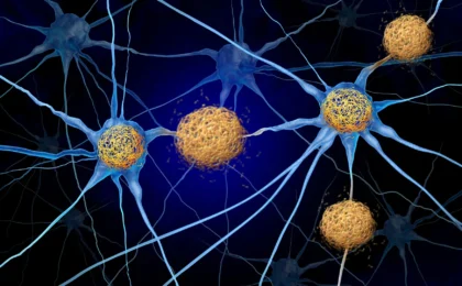 Unlocking the Silent Phase: New Research Rewrites the Timeline of Alzheimer’s Disease