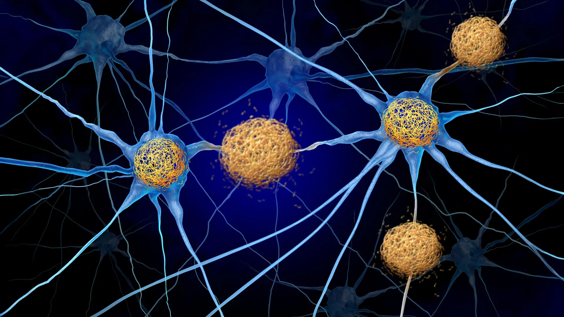 Unlocking the Silent Phase: New Research Rewrites the Timeline of Alzheimer’s Disease