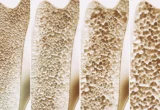 Unlocking the Skeleton’s Secret: How GPR133 Could Revolutionize Osteoporosis Treatment